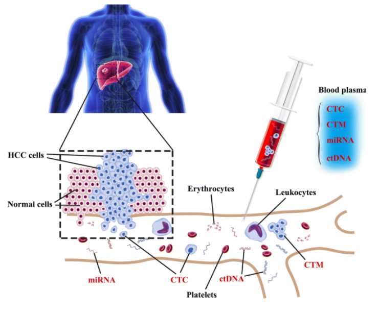 Liquid Biopsy