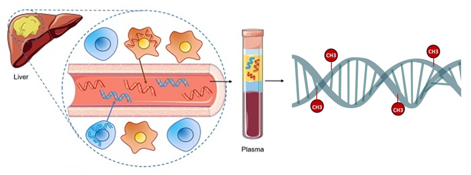 LiverMeth-Liver Cancer Gene Methylation Test